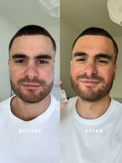 Face serum - light